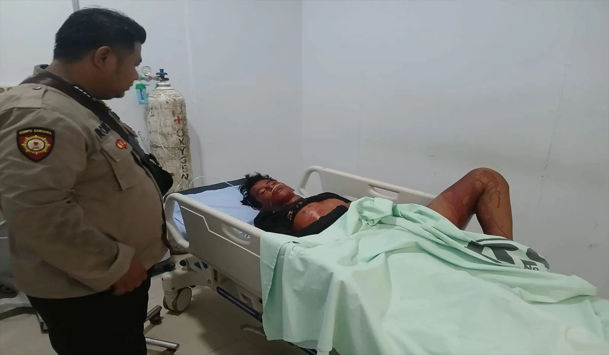Viral! Remaja di Langkat Diserang Moyet, Leher dan Perutnya Luka Gigitan